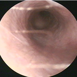 正常な耳介と耳道2