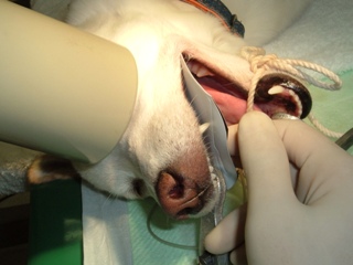 歯科レントゲン検査